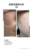 将图片加载到图库查看器,Ojesh优惠套装 6盒0.9+15盒0.6