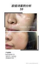 将图片加载到图库查看器,Ojesh优惠套装 16盒0.9,7支/盒