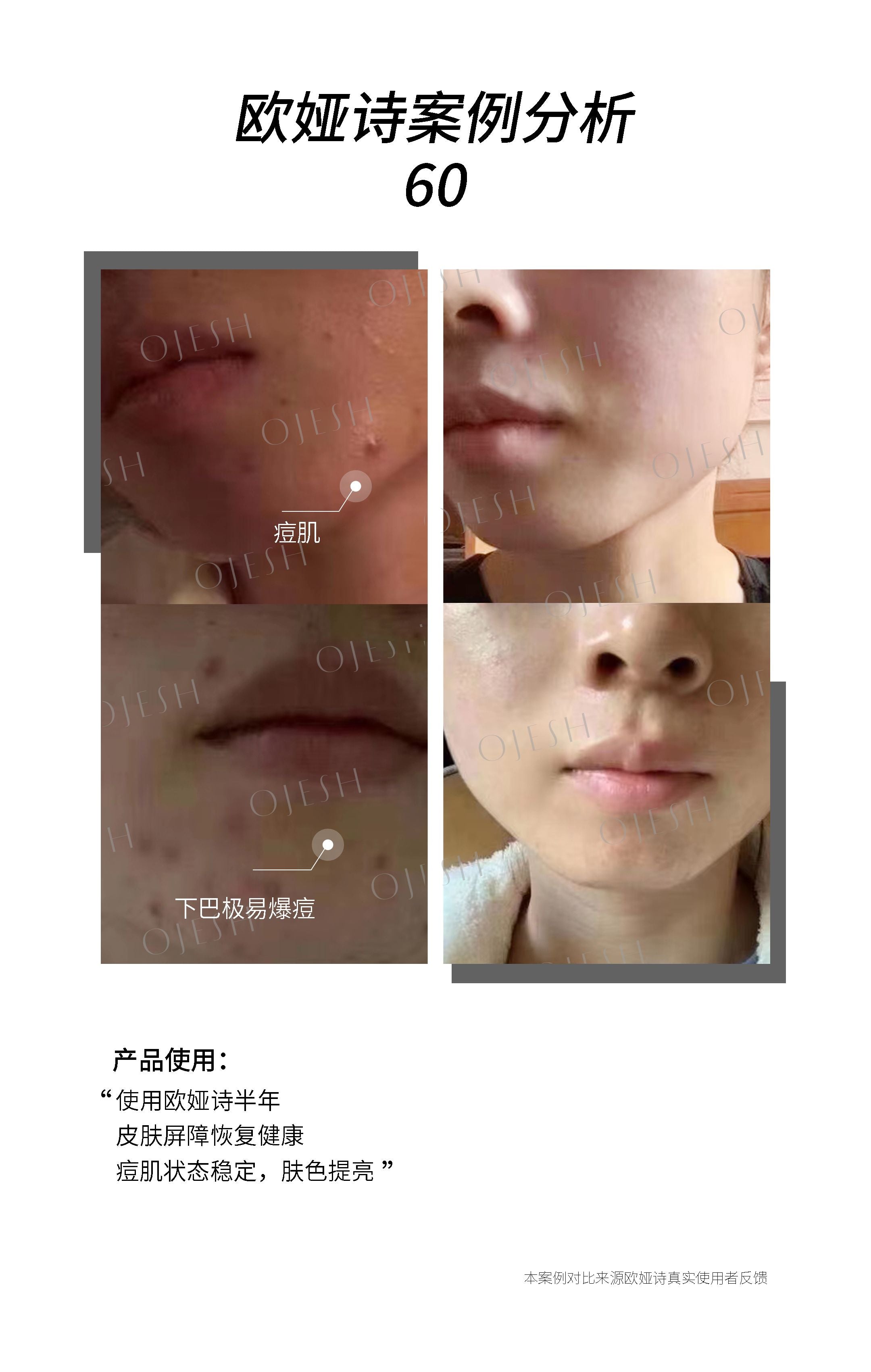 Ojesh优惠套装 9盒0.9+8盒0.8