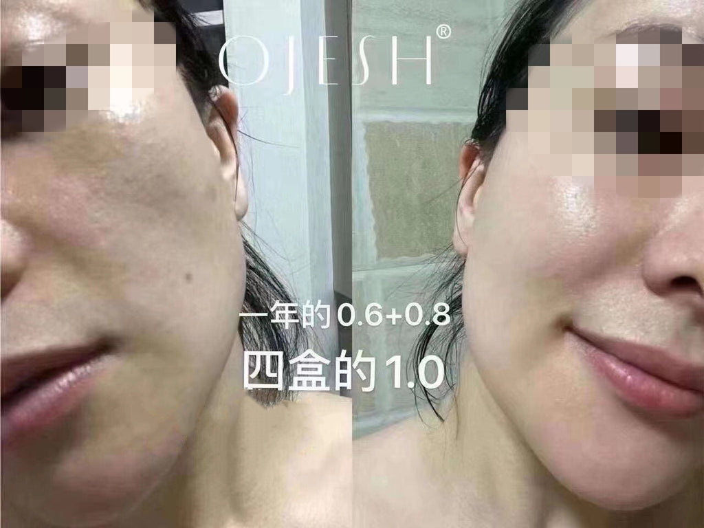 Ojesh 0.8 升级款 7支/盒